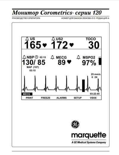 Руководство оператора, Operators Guide на Мониторы Corometrics серии 120 Rev.A (Marquette)