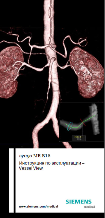 Инструкция по эксплуатации Operation (Instruction) manual на ПО syngo MR B15 Vessel View [Siemens]